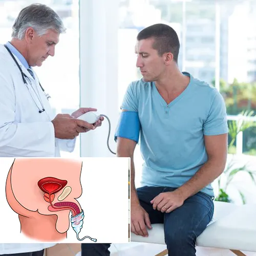 Choosing Urologist Houston

 for Your Penile Implant Surgery