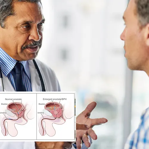 Contact  Urologist Houston 
Today for Expert Care You Can Trust