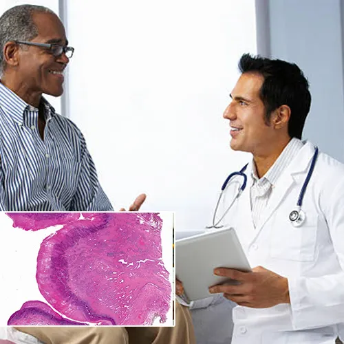 Discovering Comfort and Confidence with Penile Implants