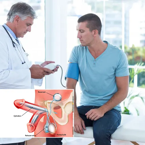 Long-Term Care and Maintenance of Your Penile Implant