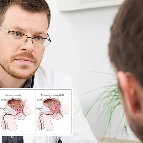 Contact  Urologist Houston 
Today